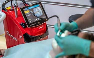 Waterlase Laser Treatment
